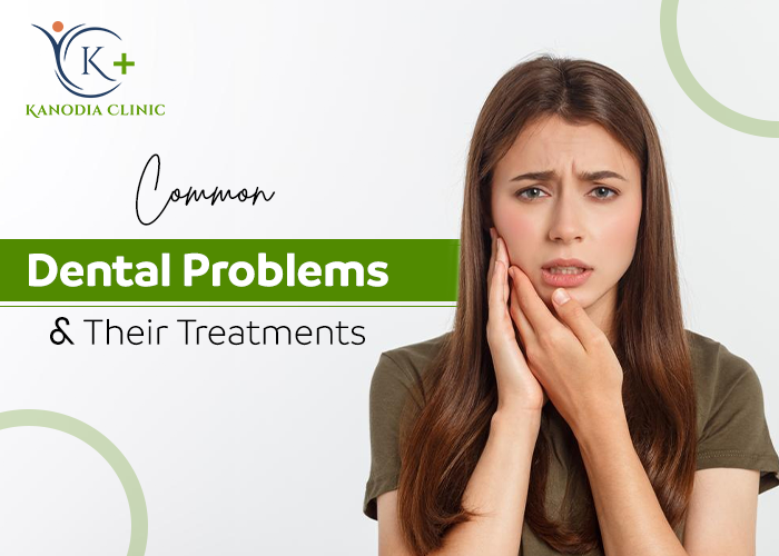 Common Dental Problems and Their Treatments